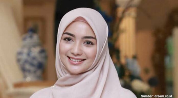 Citra Kirana Jadi Korban Pelecehan Seksual