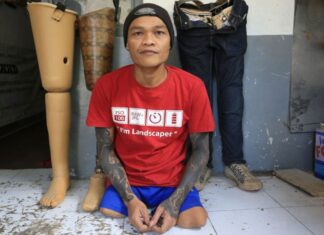 Mengharukan, Preman Ini Tobat Setelah Kakinya Tergilas Kereta Api
