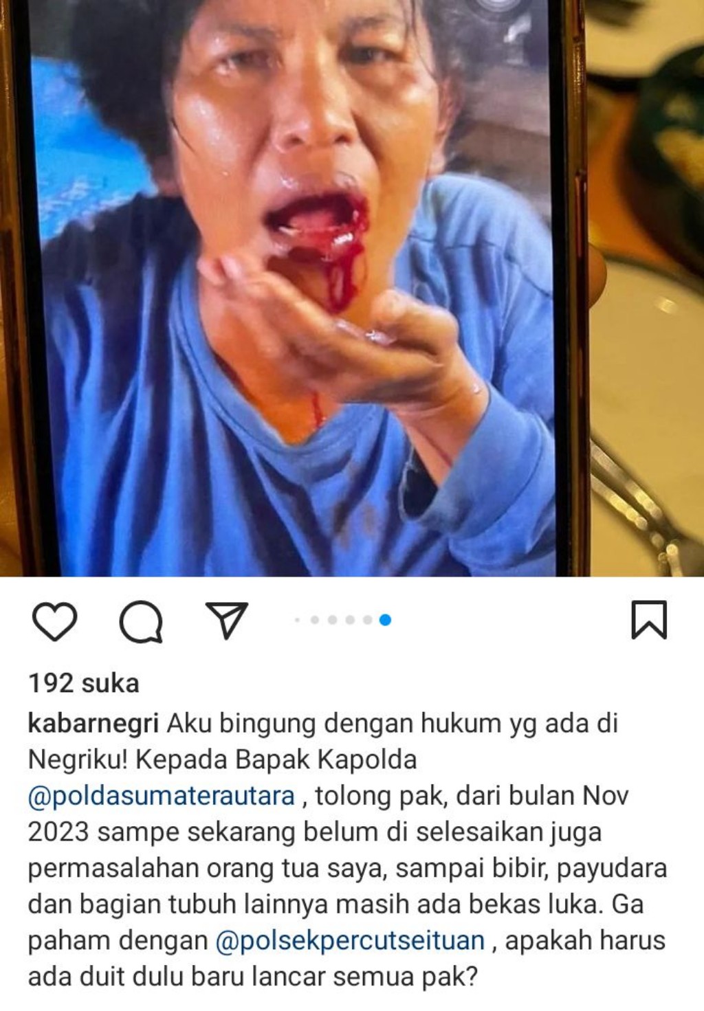 Viral, Laporan Korban Penganiayaan Tak Digubris Polisi: Ibuku Dikeroyok dan Disiram Bensin