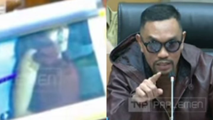 Lihat Bekas Luka Dini Dilindas Mobil Ronald Tannur, Ahmad Sahroni: Hakim Brengsek dilindas mobil