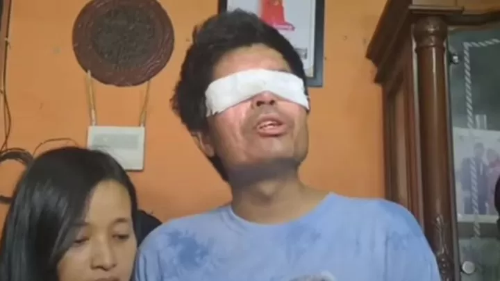 Dituduh Jual Kesedihan Demi Donasi, Agus Korban Air Keras: Saya Nggak Pernah Minta agus air keras