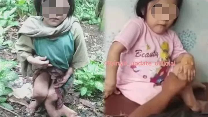 Disiksa Hingga Cacat, Bocah di Nias Selatan Sempat Dipaksa Tinggal di Kandang Ayam